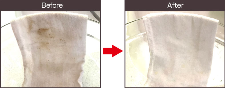 Before-After